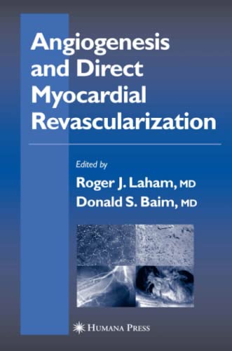 Angiogenesis and Direct Myocardial Revascularization (Contemporary Cardiology)