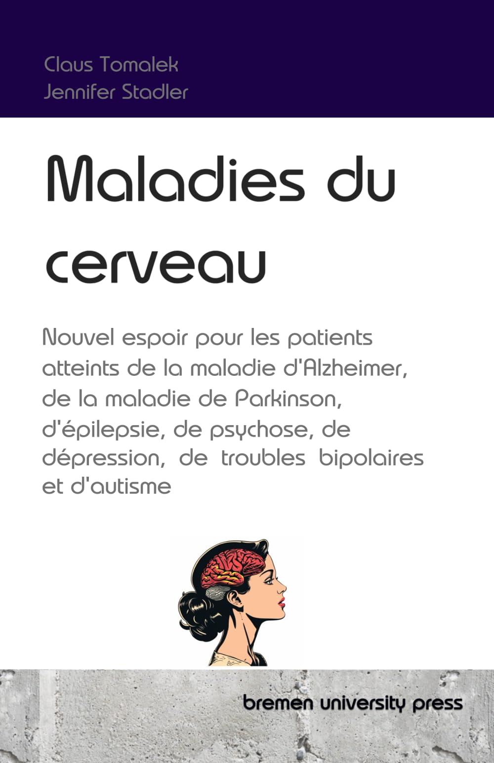 Maladies du cerveau: Nouvel espoir pour les patients atteints de la maladie d'Alzheimer, de la maladie de Parkinson, d'épilepsie, de psychose, de dépression, de troubles bipolaires et d'autisme
