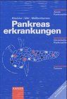 Pankreaserkrankungen (Akute Pankreatitis, Chronische Pankreatitis, Tumore)