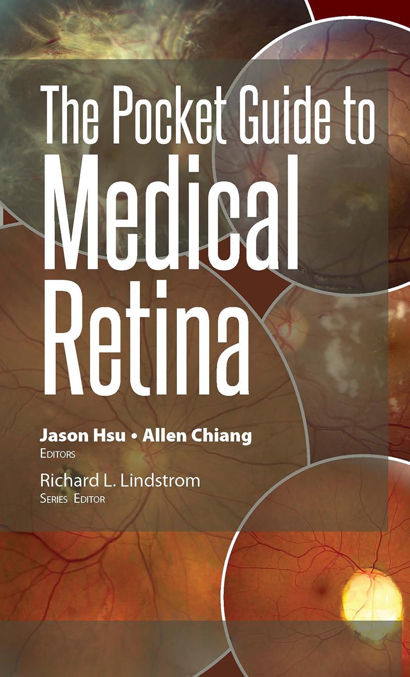 The Pocket Guide to Medical Retina (Pocket Guides)