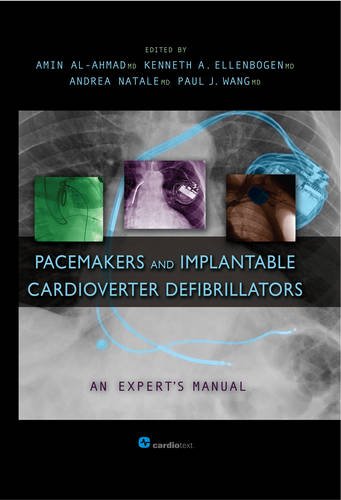 Pacemakers and Implantable Cardioverter Defibrillators