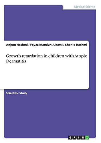 Growth retardation in children with Atopic Dermatitis