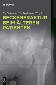 Beckenfraktur beim älteren Patienten