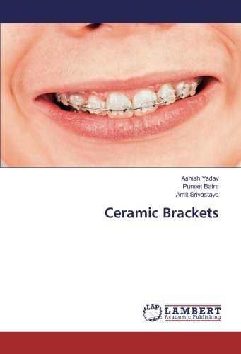 Ceramic Brackets