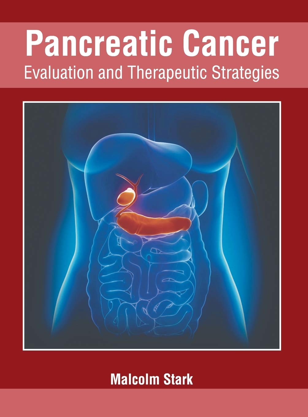 Pancreatic Cancer: Evaluation and Therapeutic Strategies
