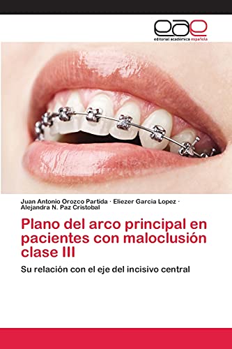 Plano del arco principal en pacientes con maloclusión clase III: Su relación con el eje del incisivo central