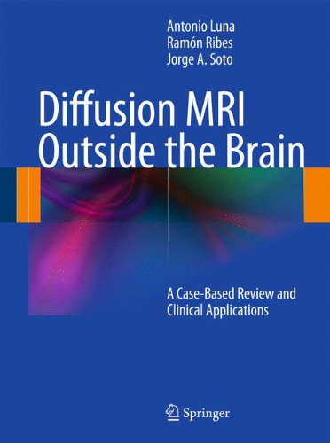 Diffusion MRI Outside the Brain - Antonio Luna Ramón Ribes Jorge A Soto Gebunden