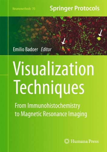 Visualization Techniques: From Immunohistochemistry to Magnetic Resonance Imaging (Neuromethods)
