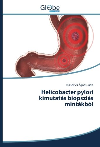 Helicobacter pylori kimutatás biopsziás mintákból