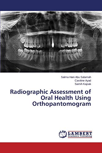 Radiographic Assessment of Oral Health Using Orthopantomogram