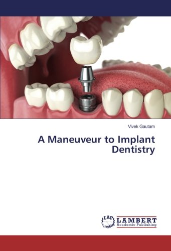 A Maneuveur to Implant Dentistry
