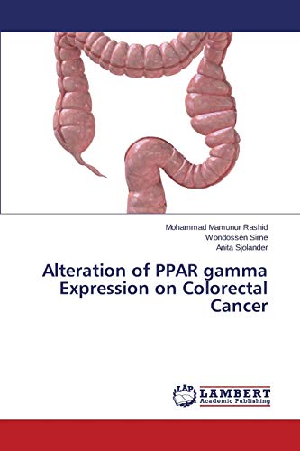 Alteration of PPAR gamma Expression on Colorectal Cancer