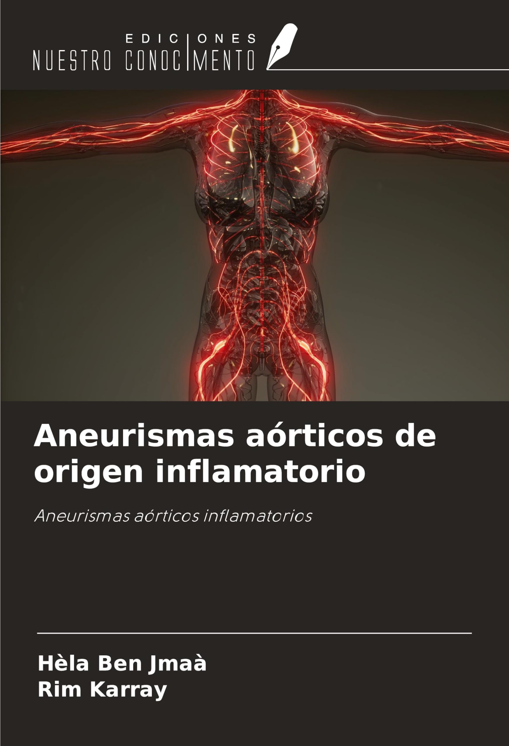 Aneurismas aórticos de origen inflamatorio: Aneurismas aórticos ...