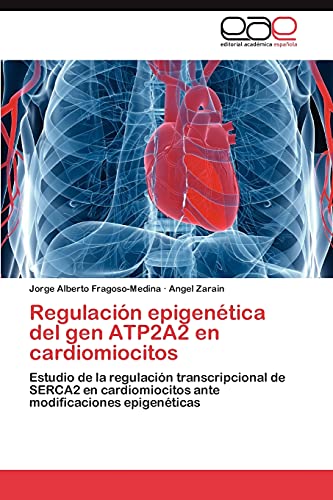Regulación epigenética del gen ATP2A2 en cardiomiocitos: Estudio de la regulación transcripcional de SERCA2 en cardiomiocitos ante modificaciones epigenéticas