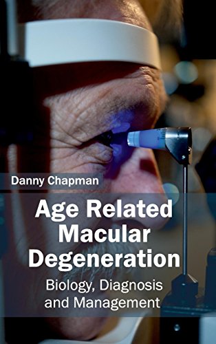 Age Related Macular Degeneration: Biology, Diagnosis and Management