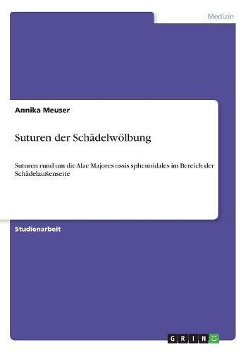 Suturen der Schädelwölbung: Suturen rund um die Alae Majores ossis sphenoidales im Bereich der Schädelaußenseite