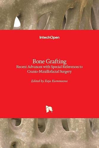 Bone Grafting: Recent Advances with Special References to Cranio-Maxillofacial Surgery