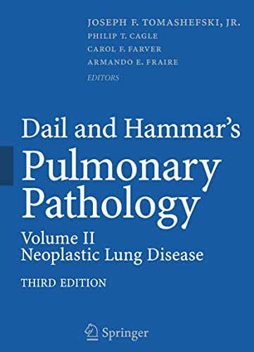 Dail and Hammar's Pulmonary Pathology: Volume II: Neoplastic Lung Disease