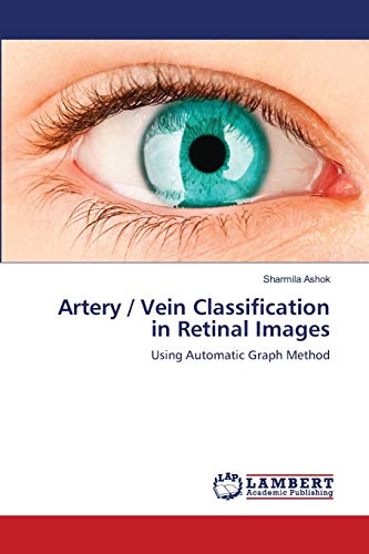Artery / Vein Classification in Retinal Images: Using Automatic Graph Method