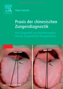 Praxis der chinesischen Zungendiagnostik: Vom Zungenbild zum Behandlungsplan und das Zungenbild im Therapieverlauf