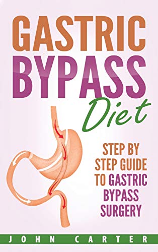 Gastric Bypass Diet: Step By Step Guide to Gastric Bypass Surgery (Bariatric Cookbook, Band 2)