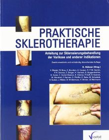 Praktische Sklerotherapie: Anleitung zur Sklerosierungsbehandlung der Varikose und anderer Indikationen