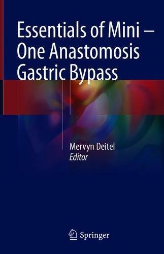 Essentials of Mini ‒ One Anastomosis Gastric Bypass