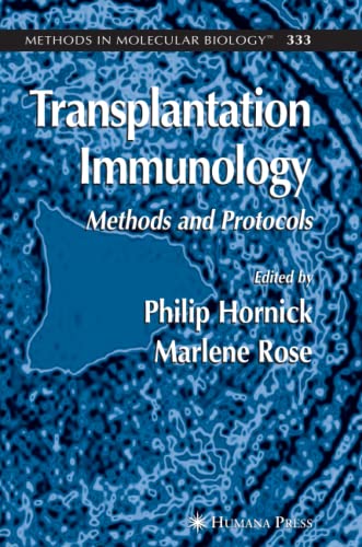 Transplantation Immunology: Methods and Protocols (Methods in Molecular Biology, Band 333)
