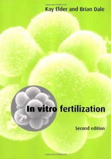 In Vitro Fertilization