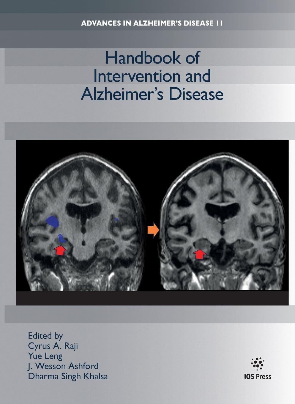Handbook of Intervention and Alzheimer's Disease