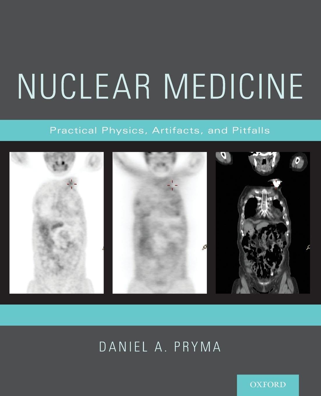 Nuclear Medicine: Practical Physics, Artifacts, and Pitfalls