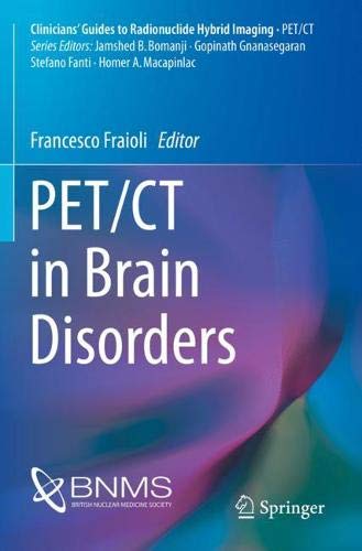PET/CT in Brain Disorders (Clinicians’ Guides to Radionuclide Hybrid Imaging)