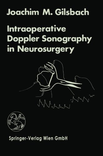 Intraoperative Doppler Sonography in Neurosurgery