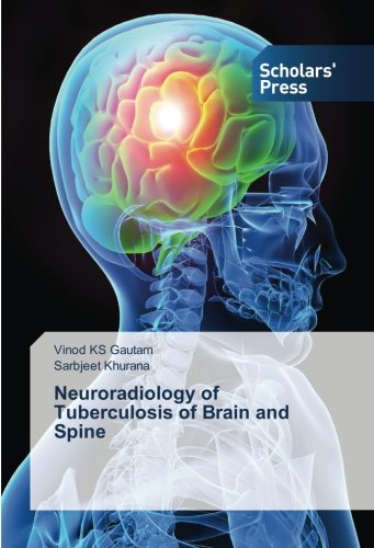 Neuroradiology of Tuberculosis of Brain and Spine