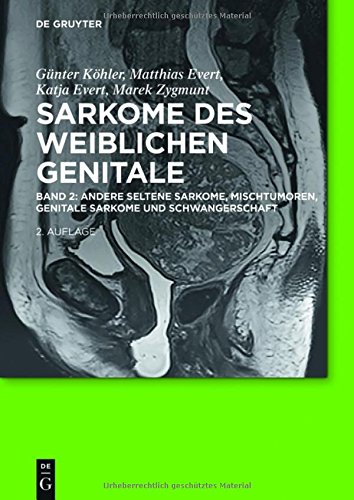 Sarkome des weiblichen Genitale: Andere seltene Sarkome, Mischtumoren, genitale Sarkome und Schwangerschaft: Band 2: andere seltene Sarkome, Mischtumoren, genitale Sarkome und Schwangerschaft