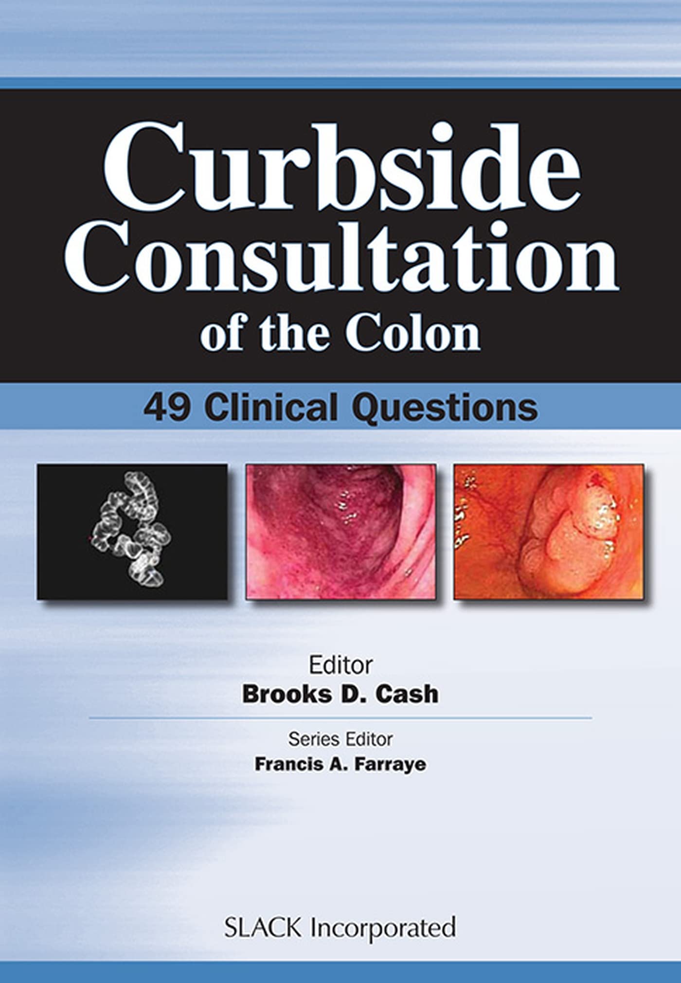 Curbside Consultation of the Colon: 49 Clinical Questions (Curbside Consultation in Gastroenterology)
