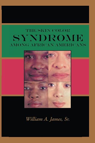 The Skin Color Syndrome Among African-Americans