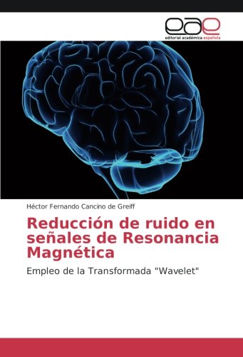 Reducción de ruido en señales de Resonancia Magnética: Empleo de la Transformada Wavelet