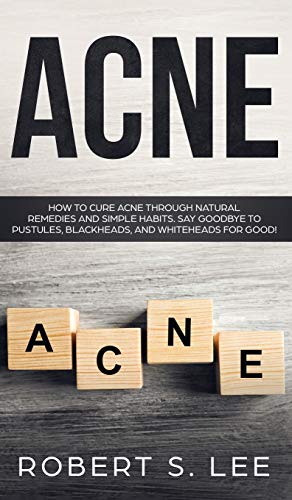 Acne: How to Cure Acne through Natural Remedies and Simple Habits. Say Goodbye to Pustules, Blackheads and Whiteheads for Good!