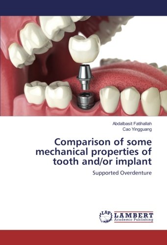 Comparison of some mechanical properties of tooth and/or implant: Supported Overdenture
