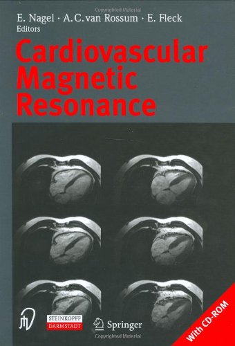 Cardiovascular Magnetic Resonance