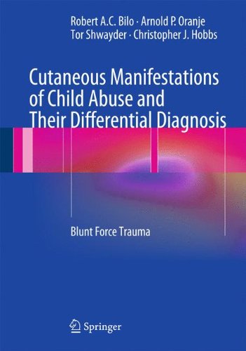 Cutaneous Manifestations of Child Abuse and Their Differential Diagnosis: Blunt Force Trauma