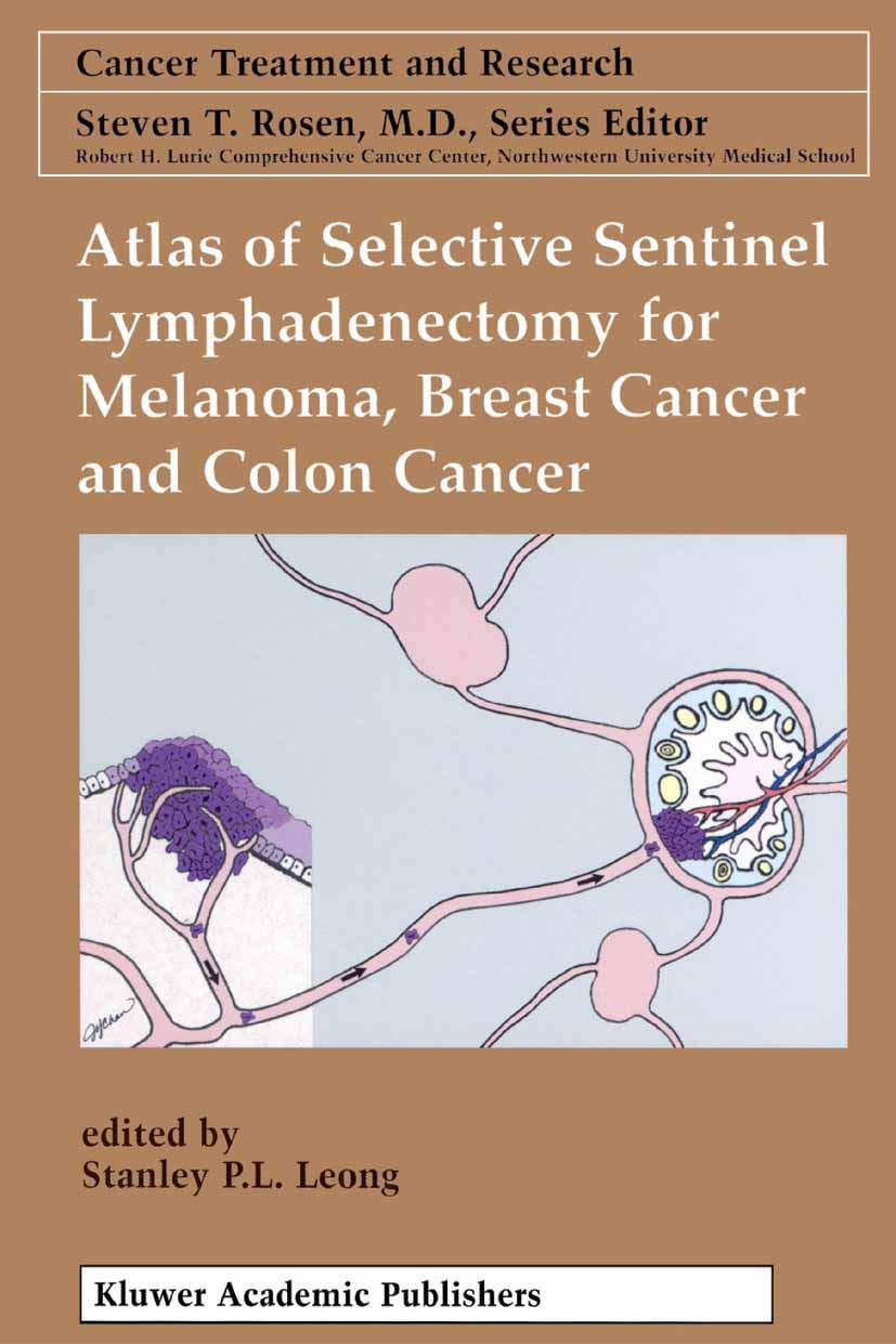 Atlas of Selective Sentinel Lymphadenectomy for Melanoma, Breast Cancer and Colon Cancer (Cancer Treatment and Research, 111, Band 111)