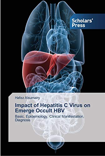 Impact of Hepatitis C Virus on Emerge Occult HBV: Basic, Epidemiology, Clinical Manifestation, Diagnosis