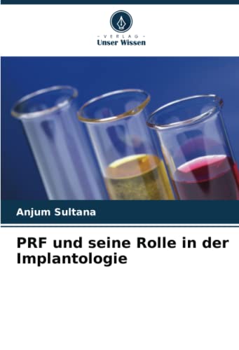 PRF und seine Rolle in der Implantologie