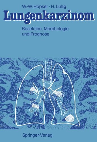 Lungenkarzinom: Resektion, Morphologie und Prognose (German Edition)