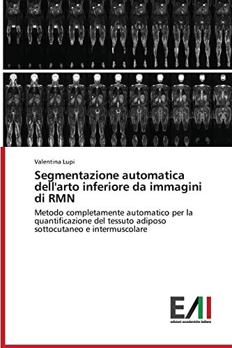 Segmentazione automatica dell'arto inferiore da immagini di RMN: Metodo completamente automatico per la quantificazione del tessuto adiposo sottocutaneo e intermuscolare