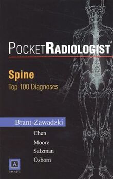 Spine: Top 100 Diagnoses (Pocketradiologist)