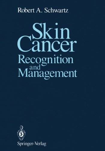 Skin Cancer: Recognition and Management
