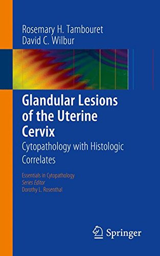 Glandular Lesions of the Uterine Cervix: Cytopathology with Histologic Correlates (Essentials in Cytopathology)